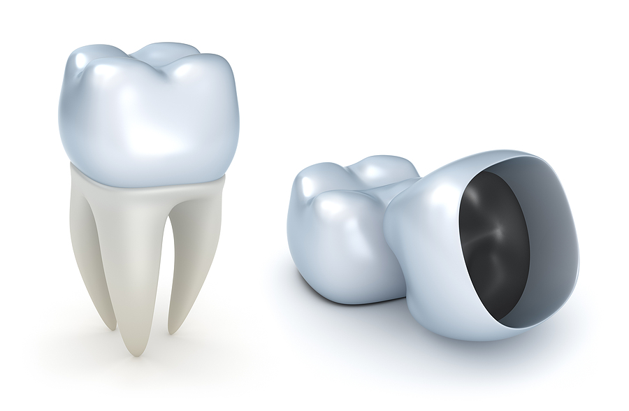 Restore Your Smile & Confidence: Everything You Need to Know About Dental Crowns in Houston, TX