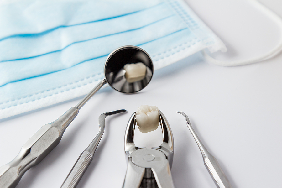 Everything You Need to Know About Tooth Extractions in Houston, TX
